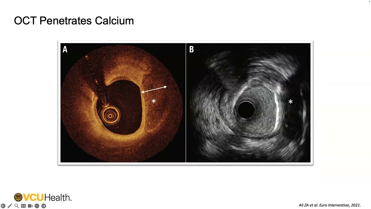 Pauley Heart Center Cardiology Grand Rounds - July 13, 2024