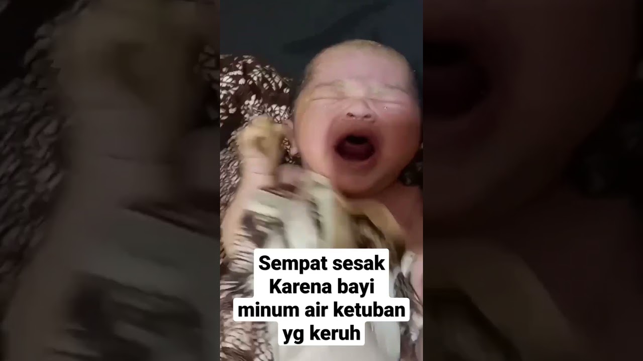 AIR KETUBAN KERUH || BAYI SEMPAT SESAK NAPAS