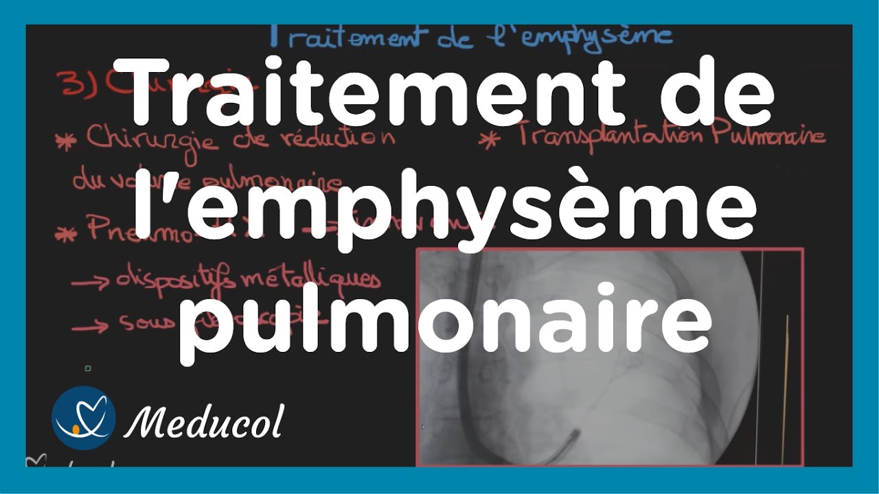 Emphysème pulmonaire: traitement de l'emphysème