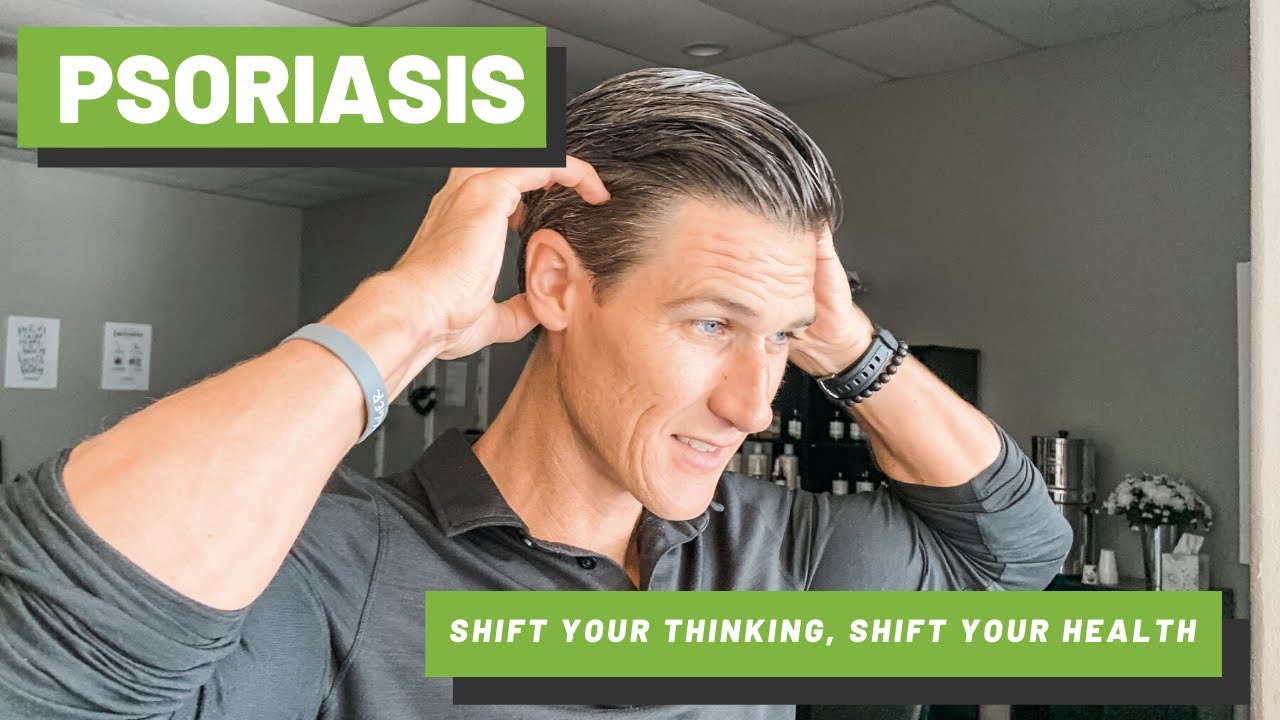How I Healed My Psoriasis Without Any Medication | Heal Psoriasis Naturally