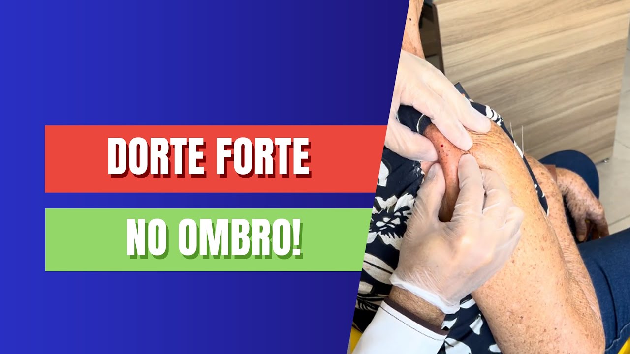 Você não vai acreditar! Ela chegou com muita DOR NO OMBRO e SEM MOBILIDADE, mas saiu MUITO MELHOR!