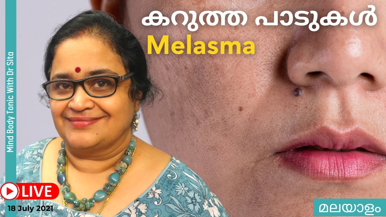 ചർമ്മത്തിലെ കറുത്ത പാടുകൾ ഇല്ലാതാക്കാൻ |Dark Spots In The Skin|Melasma-  How To Manage| Dr Sita