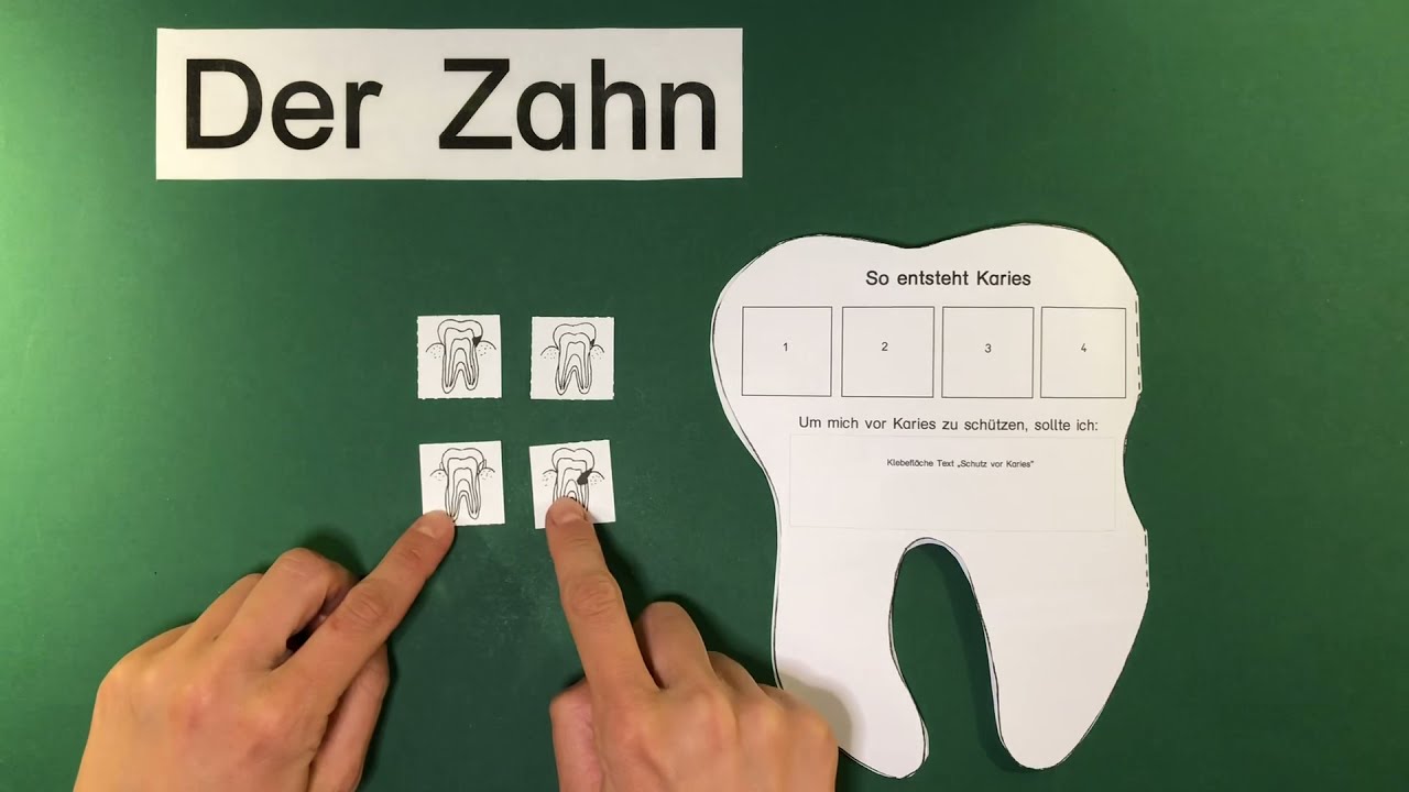 Klasse 1 und 2 - Karies (Teil 2)
