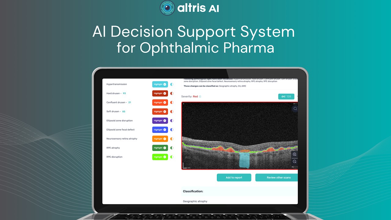 AI Decision Support for OCT for Pharma