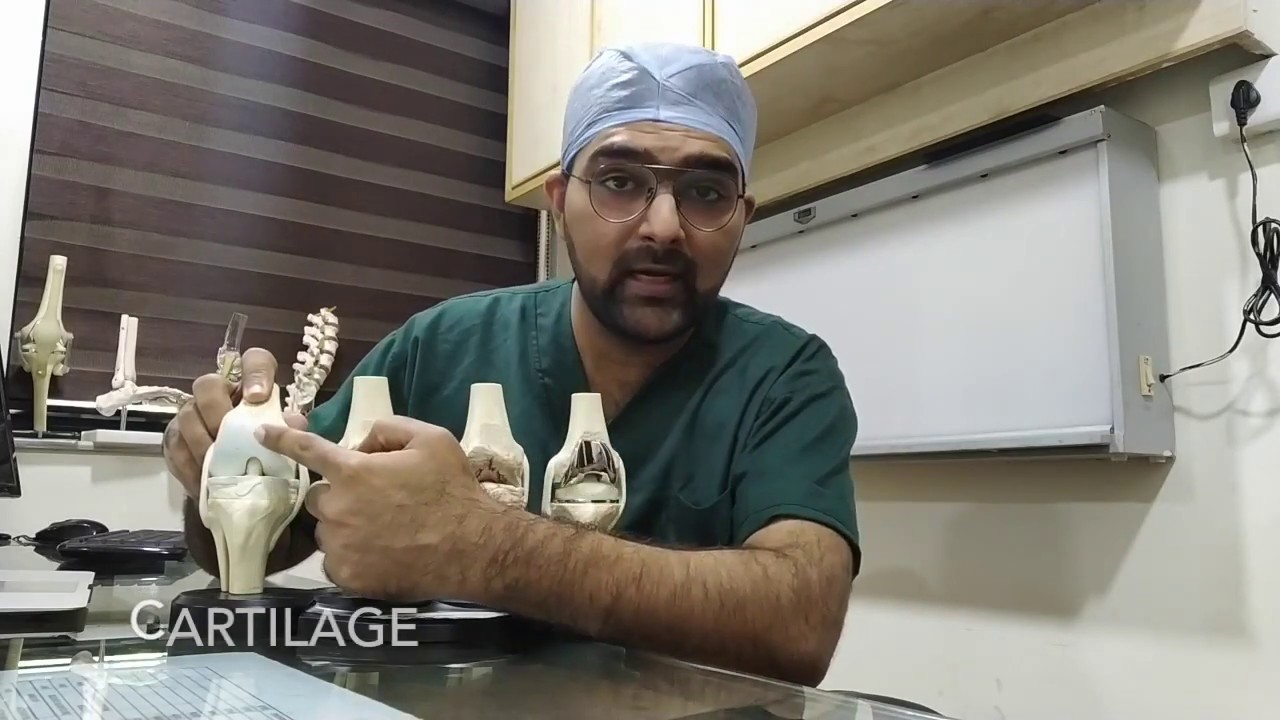 Why does knee pain occur? (In Hindi) - Patient Education Video