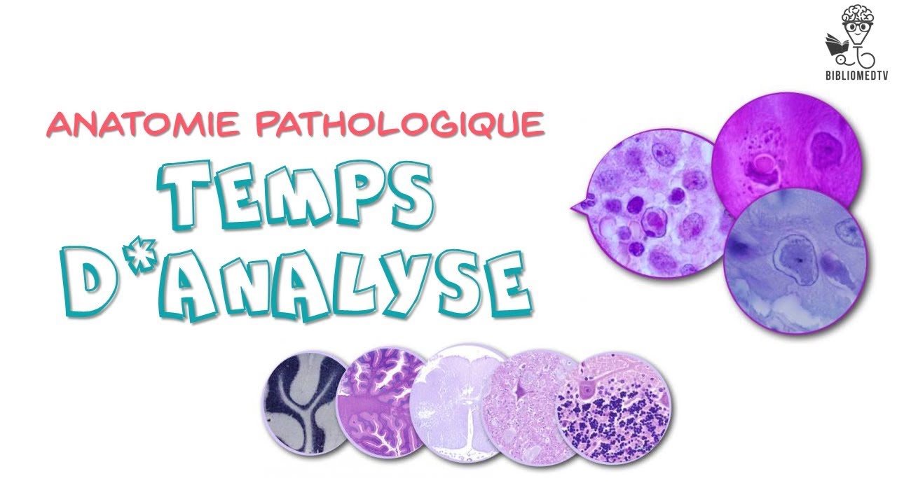 Anatomie Pathologique - Temps d'Analyse