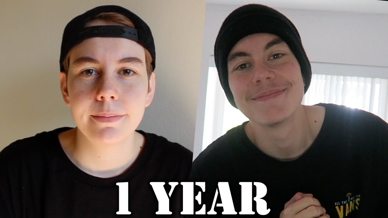 1 Year on Testosterone & 6 Months Post-Op / FtM Transition