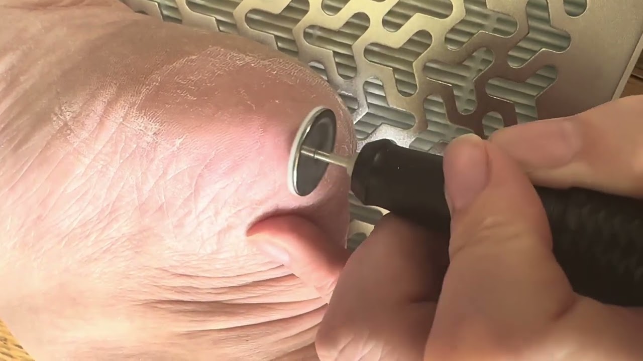 E-File Pedicure Hard Skin Removal using Sanding Discs