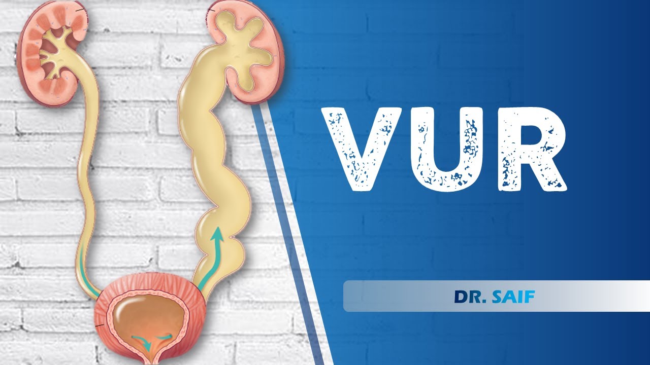 VesicoUreteral Reflux || DR. SAIF || LECTURE 3