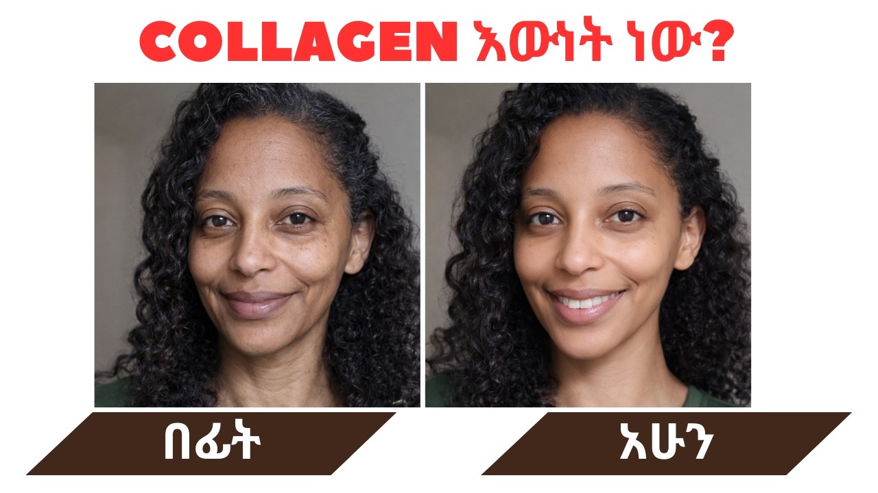 ኮላጅን (Collagen) ጠቃሚ ወይስ የገንዘብ ማባከኛ?  | Glow & Go Wellness