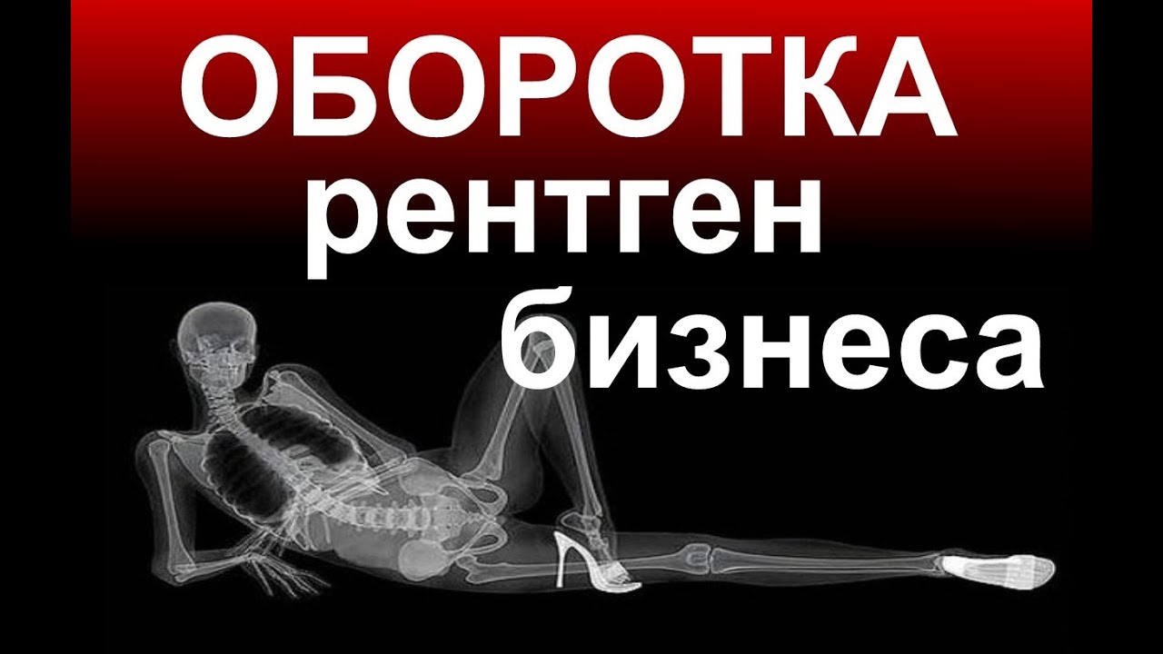 Бухучет. ОБОРОТКА, как рентген КОМПАНИИ или БАРДАК в бухучете по Оборотно-сальдовой ведомости