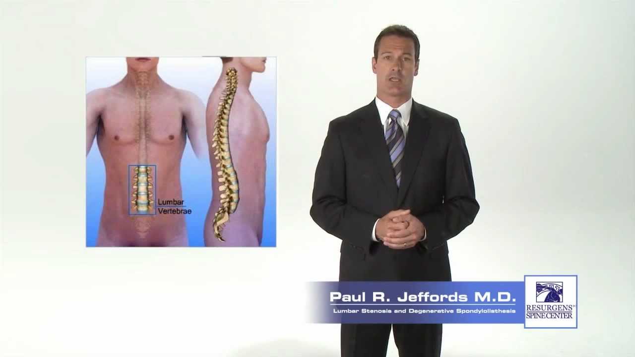 Lumbar Spinal Stenosis - Paul R. Jeffords, M.D.