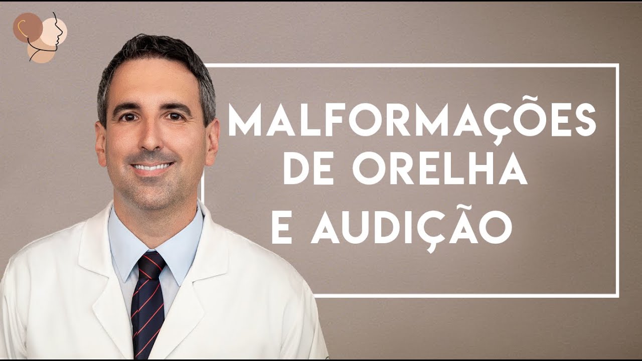 Dr. Felippe Felix - Malforma&ccedil;&otilde;es de Orelha x Audi&ccedil;&atilde;o