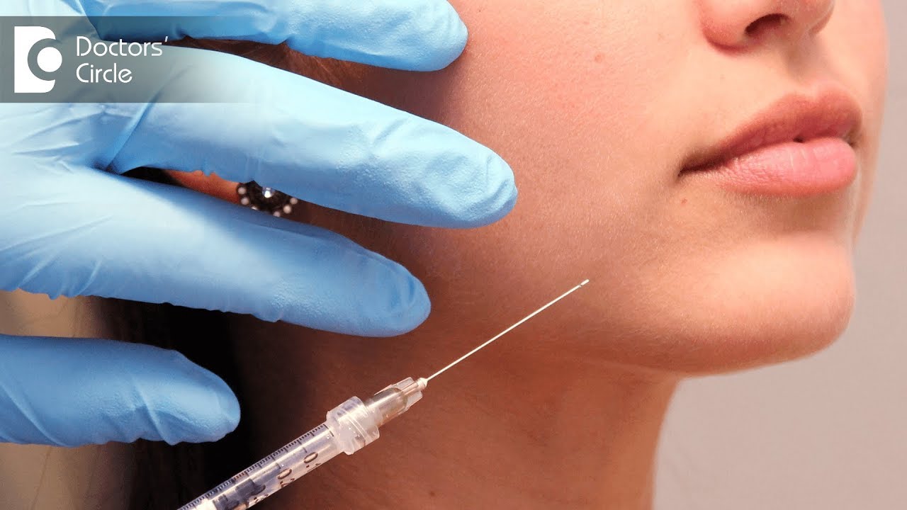 How is dermal filler procedure done? - Dr. K C Nischal