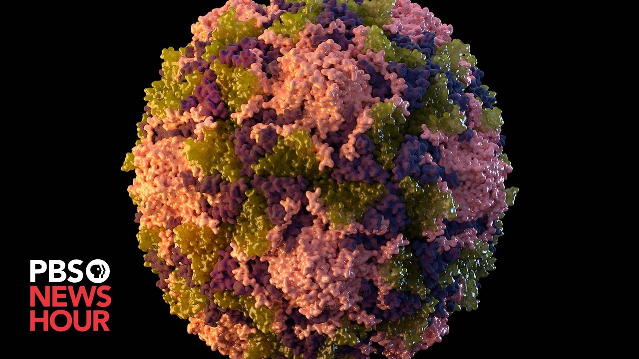 Public health experts sound the alarm as new polio cases emerge
