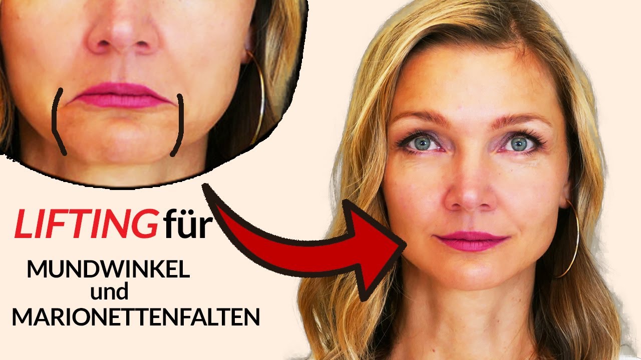 LIFTING für hängende Mundwinkel & Marionettenfalten ✨ (Botox-Effekt!)