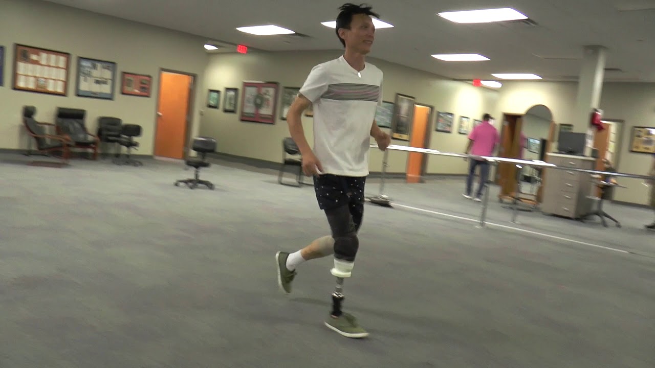 Kelvin Travelled from Singapore for POA Prosthetic Care