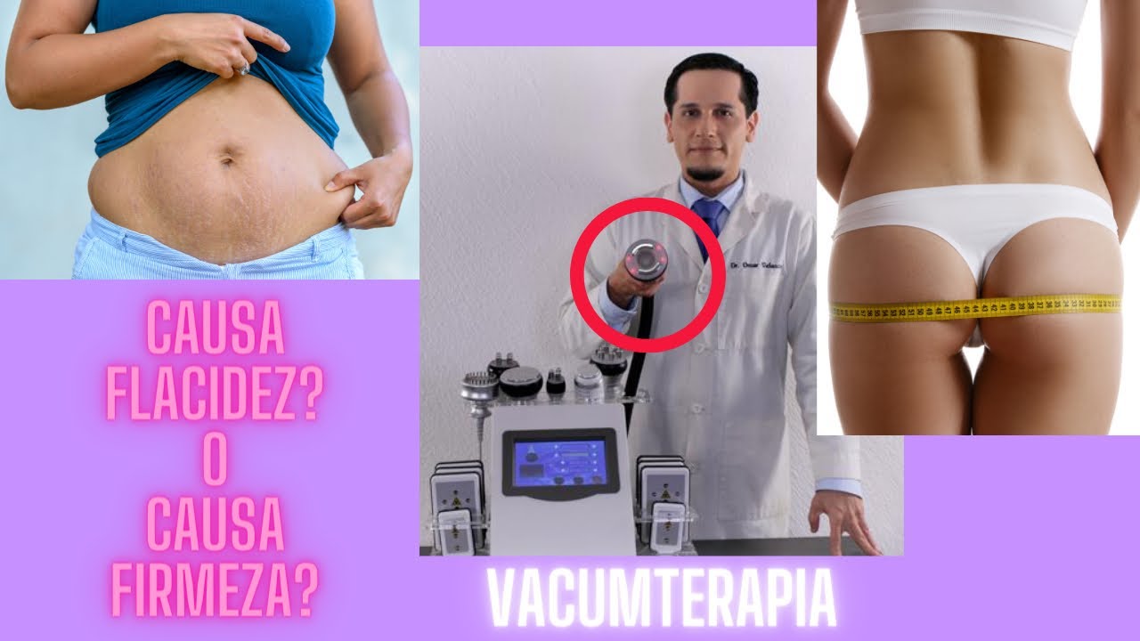 La VACUMTERAPIA causa FLACIDEZ?
