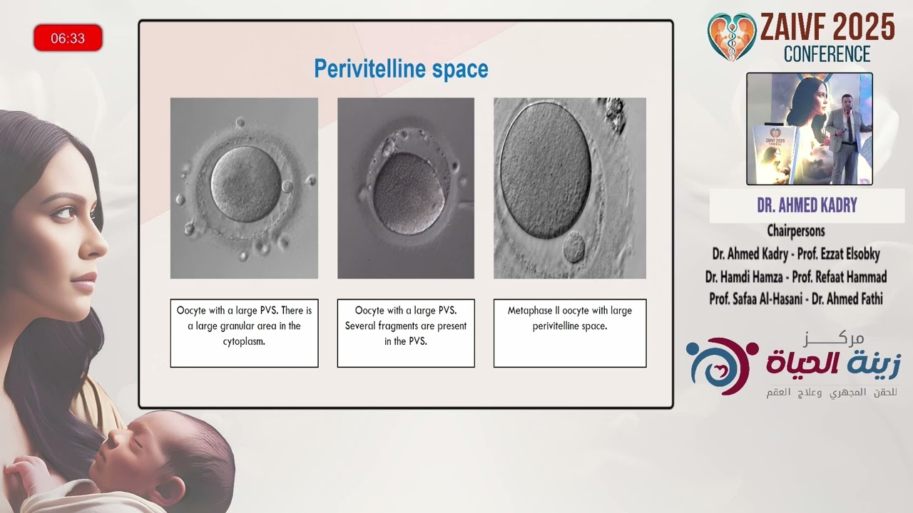 محاضرة دكتور احمد قدري من مؤتمر ZAIVF  في دورته التانية