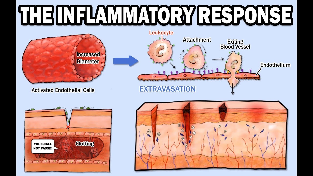 THE INFLAMMATORY RESPONSE