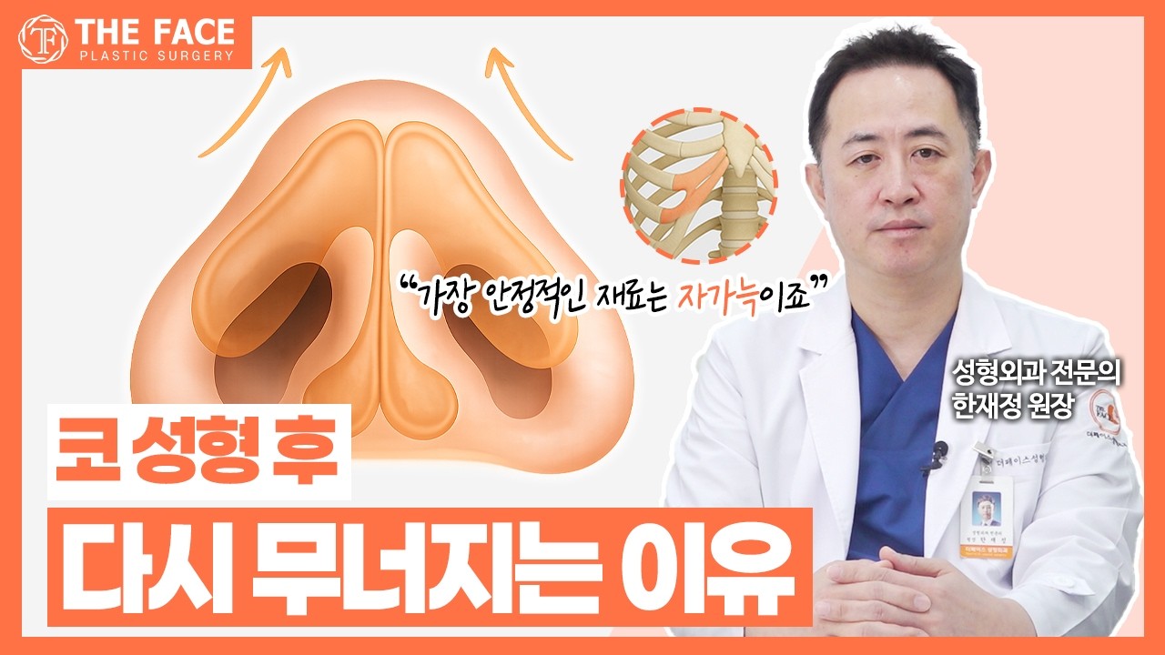코 재수술, 더 이상의 실패는 NO! _ 코 재수술