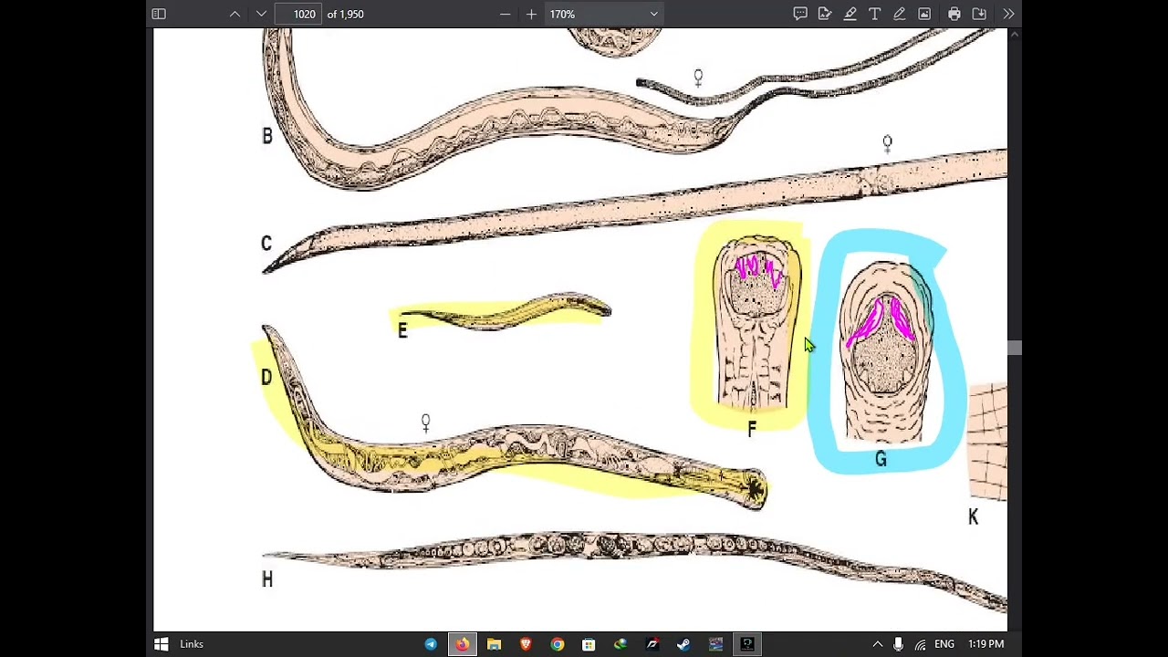 CH56# Ancylostoma & Necorta/جزء ثاني 