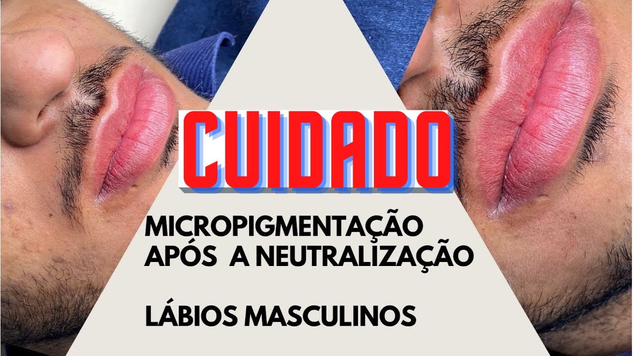Cuidados com a micropigmentação após neutralização dos Lábios Masculinos!