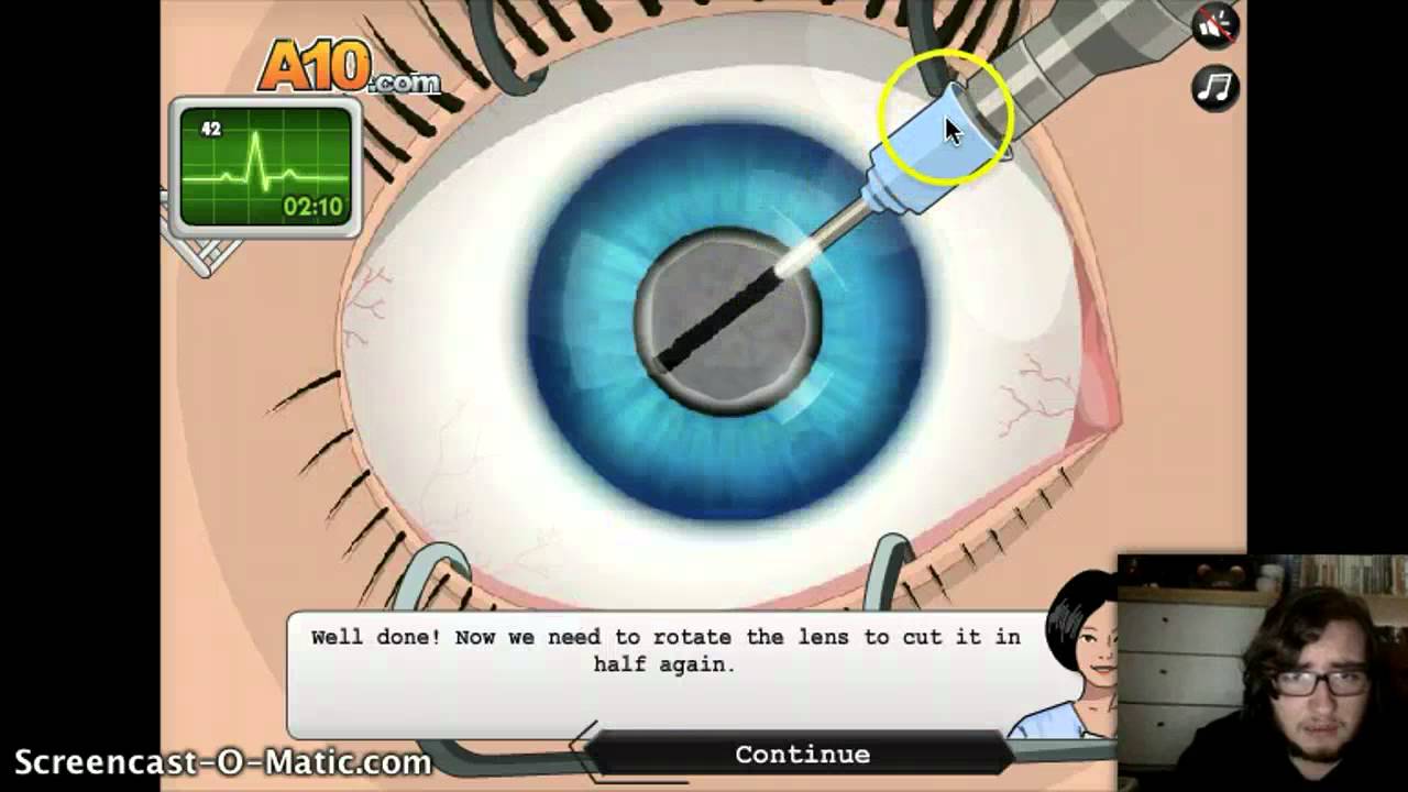 Alanomaly - Eye Surgery - NOT VERY EYECONIC