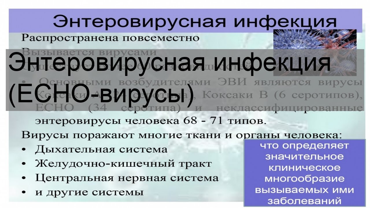 Энтеровирусная инфекция (ECHO-вирусы)
