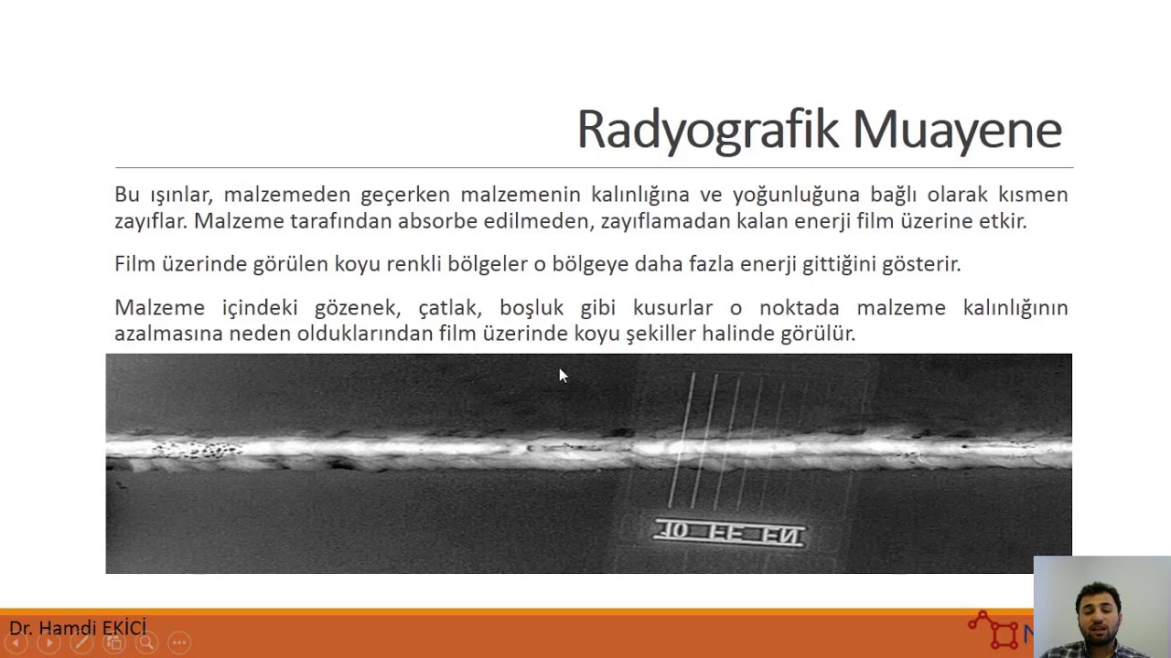 Radyografik Muayene