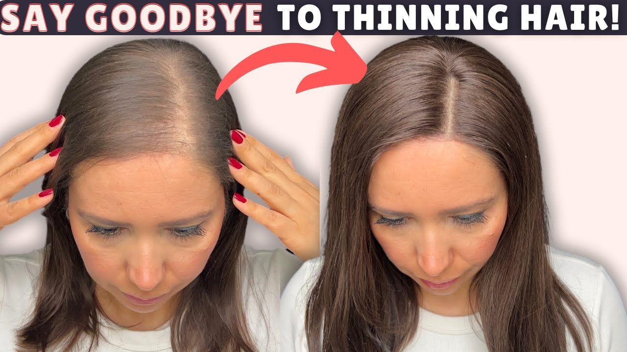 Breeze Hair Topper for Receding Hairline