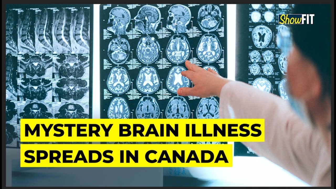 Mystery Brain Disease Is Affecting Canada's Young l Whistleblower Sounds Alarm | ShowFit