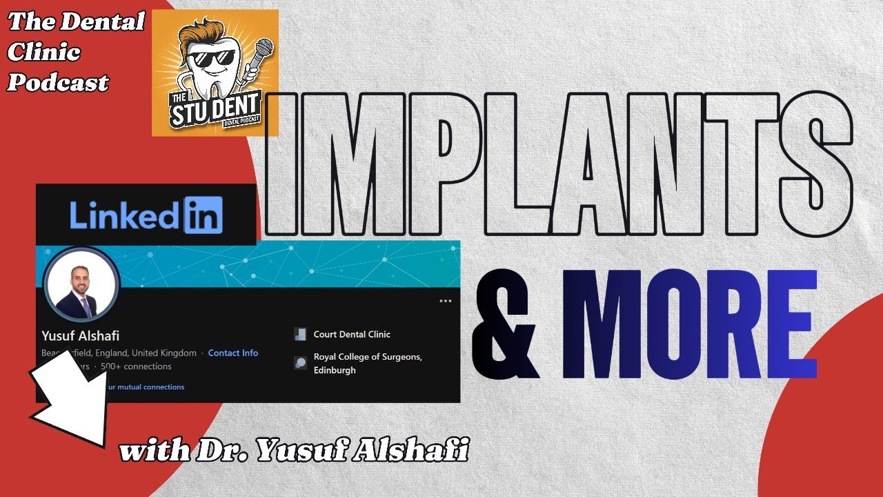 Dr Yusuf Alshafi, let's talk Implants - Dental Clinic Podcast #023