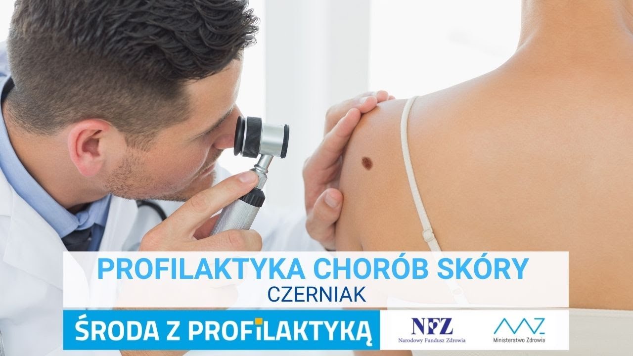 Profilaktyka chor&oacute;b sk&oacute;ry - czerniak
