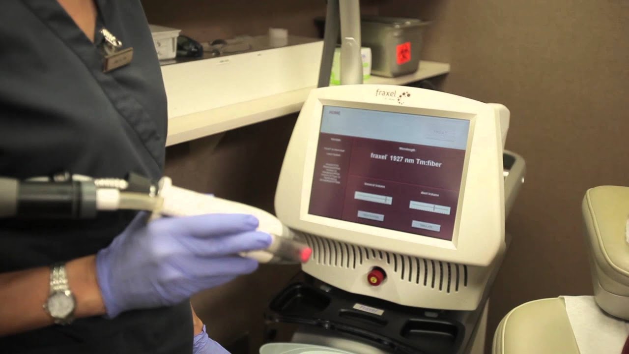 Fractional laser treatments at the Laser & Skin Surgery Center of Northern California
