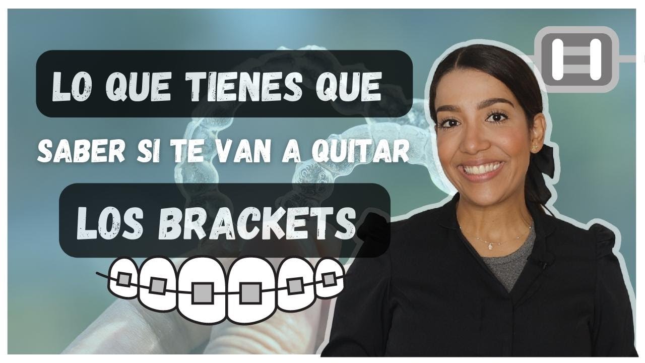 Esto es lo que tienes que saber antes de retirar los brackets.