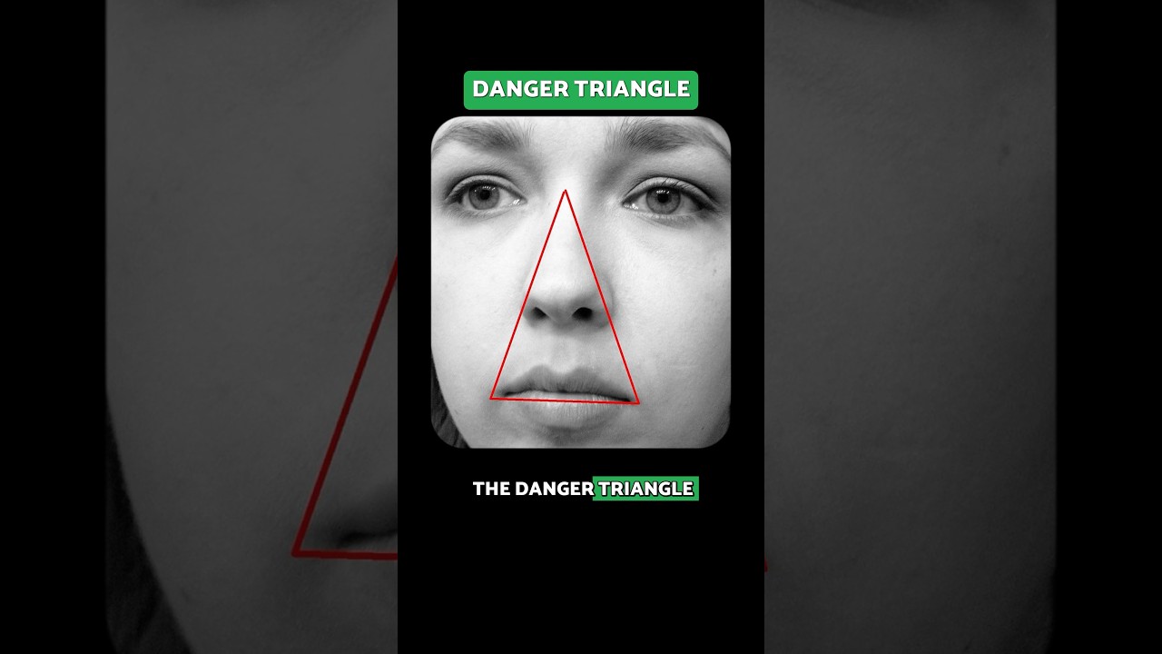 Dangerous Area of Face: Why You Should Never Pop a Pimple On Your Nose | Dermatologist Explains