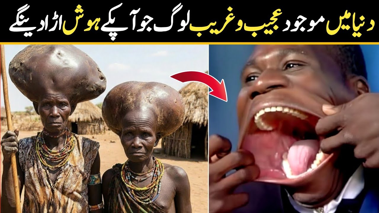 8 Most Unbelievable Human Body Records In The World | Real & Verified