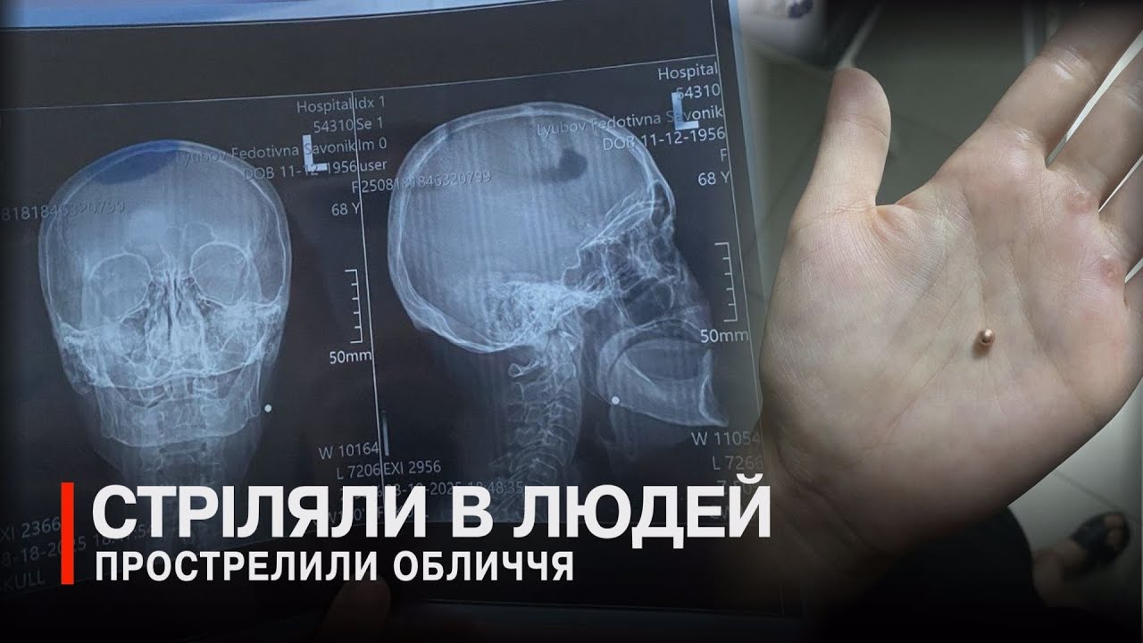 Працівники ТЦК влаштували стрілянину у жінок, що стали на заваді бусифікації чоловіка з інвалідністю