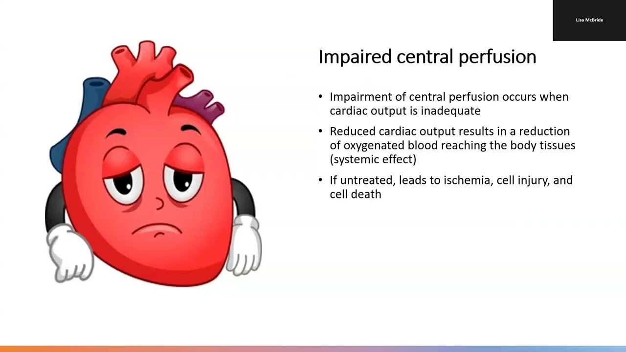 Week 8 Lecture 1 Perfusion Part 1 Prof McBride
