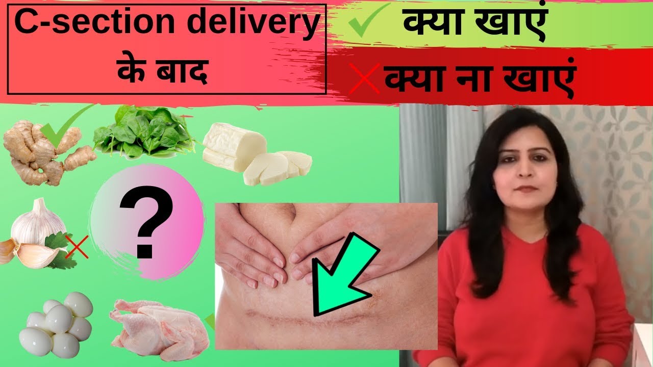 सिजेरीयन डिलीवरी के बाद क्या खाए क्या बिल्कुल नहीं खाए |Diet after cesarean delivery indian in hindi