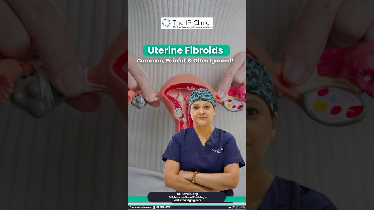 What Are Uterine Fibroids? Causes, Symptoms & Treatments | Doctor Explains 🌸🧠