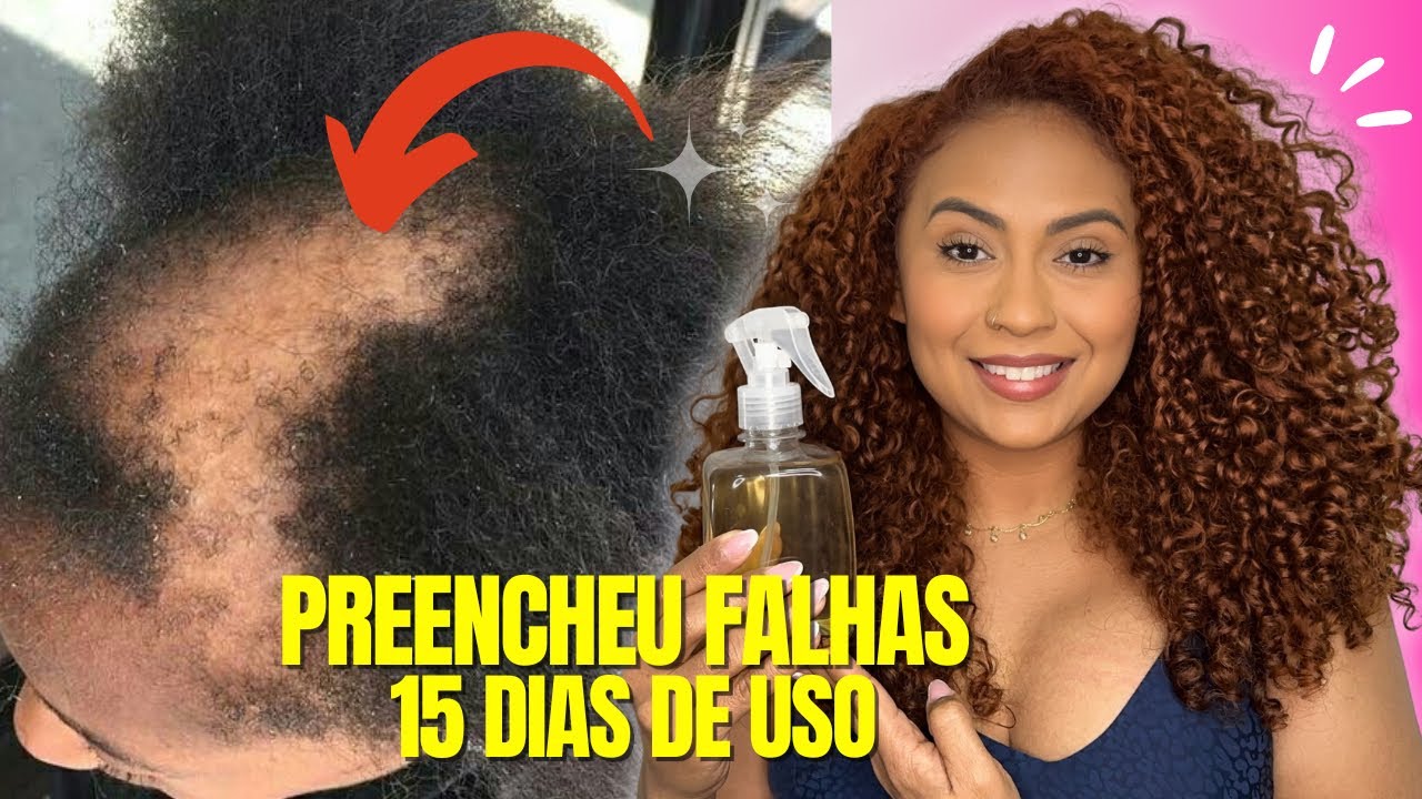 🔥 O cabelo cresce loucamente e não cai, esse é o melhor remédio. 4 ingredientes poderosos!