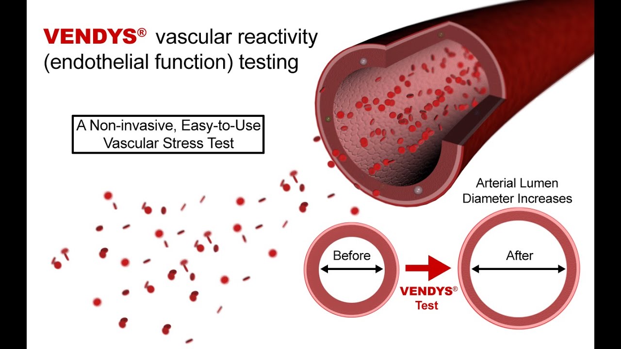 VENDYS -- Endothelial Function Measurement Explained
