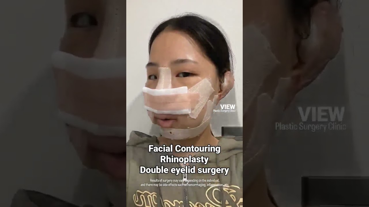 This is why you have to choose VIEW Plastic Surgery✨️💛