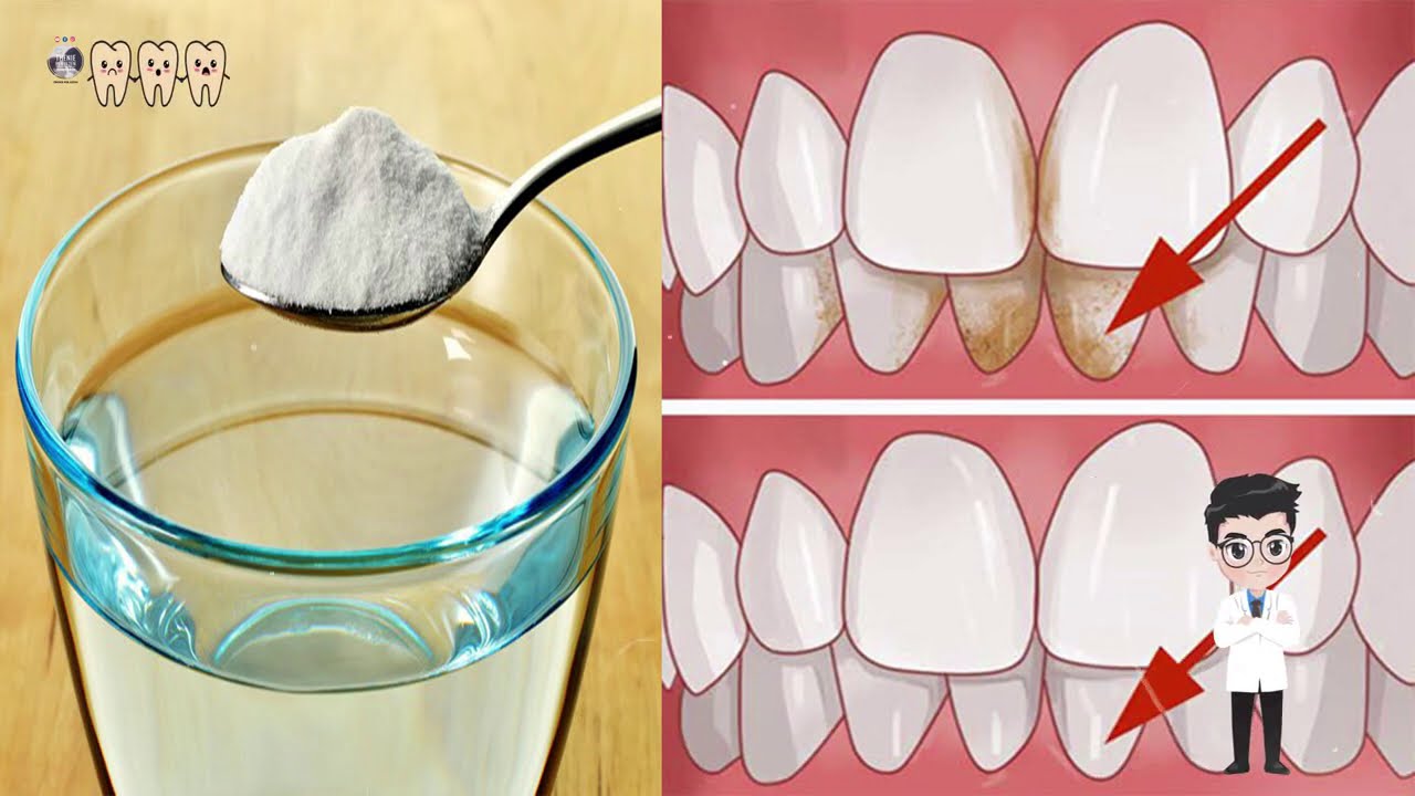 Ja si te pastroni gurzat sa hap e mbyll syte me keta perberes te thjeshte qe i keni ne shtepine tuaj