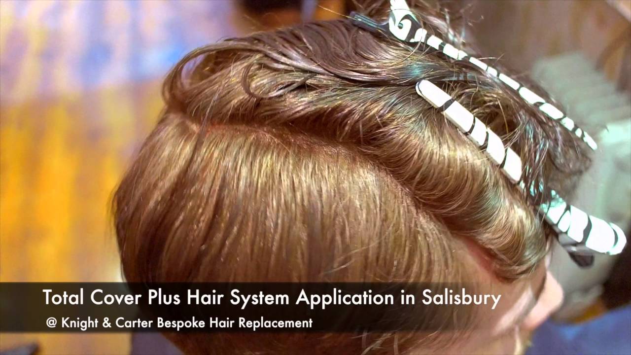 Hair Systems in Salisbury by Total Cover Plus