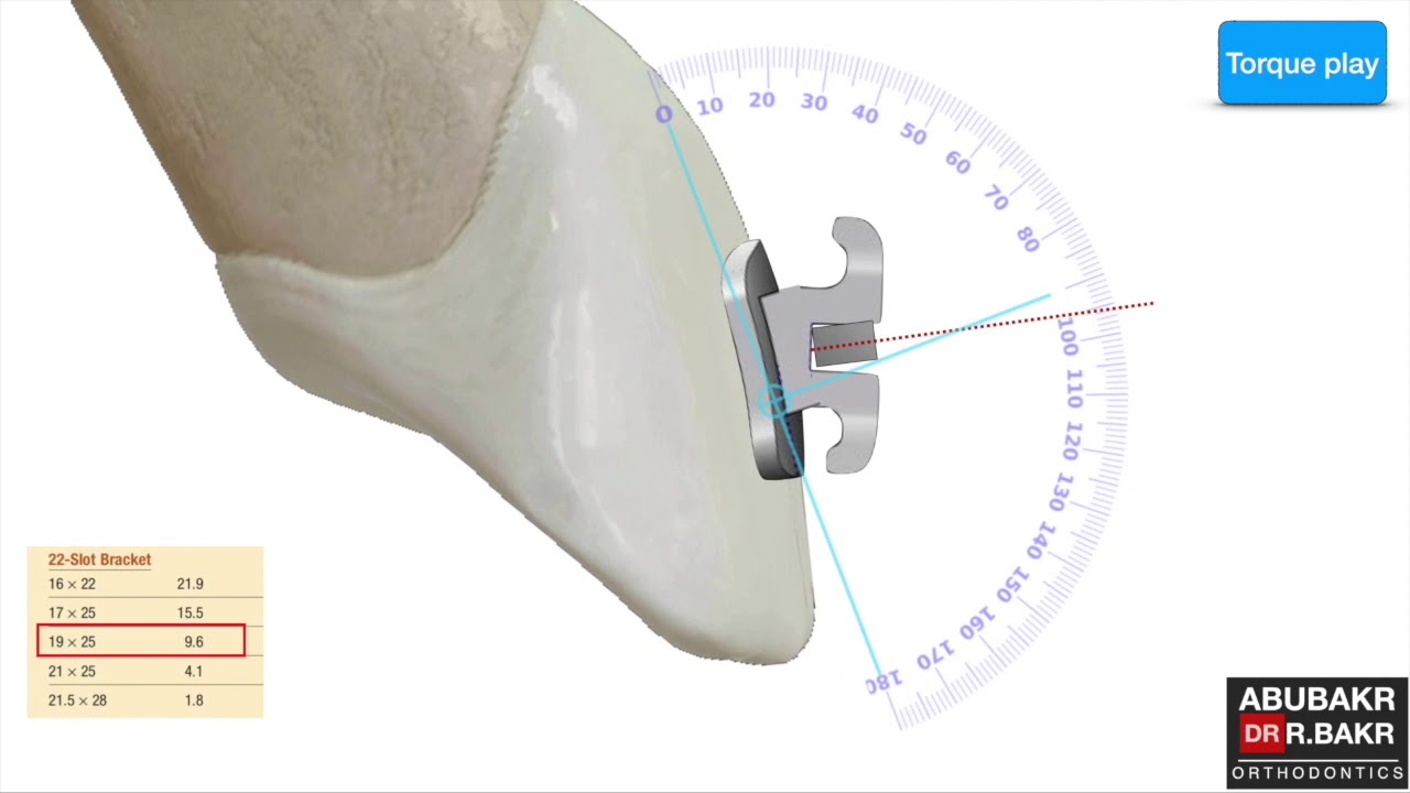 I) why we need to control the torque during labial segment retraction?