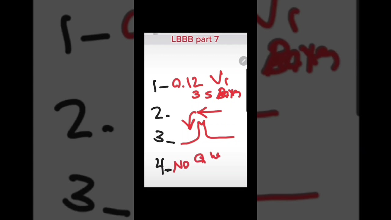 Left Bundle Branch Block