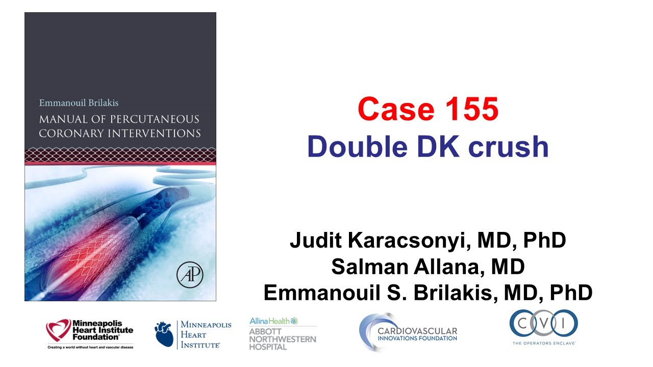 Case 155: Manual of PCI - Double DK crush